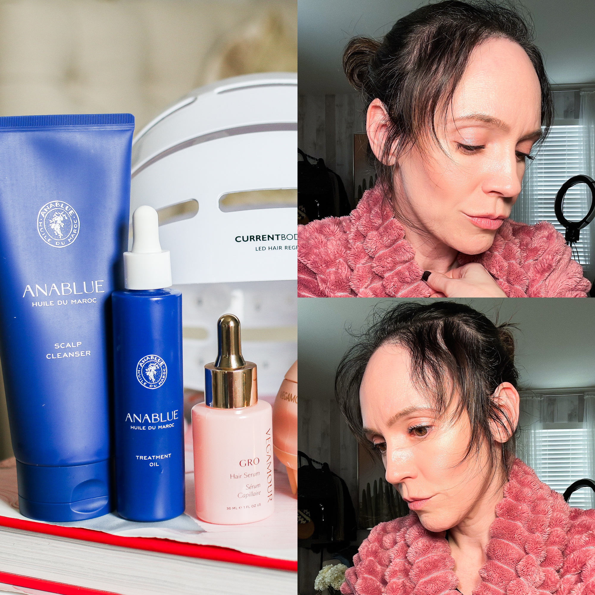 Hair Growth Products Best Hair Growth Products