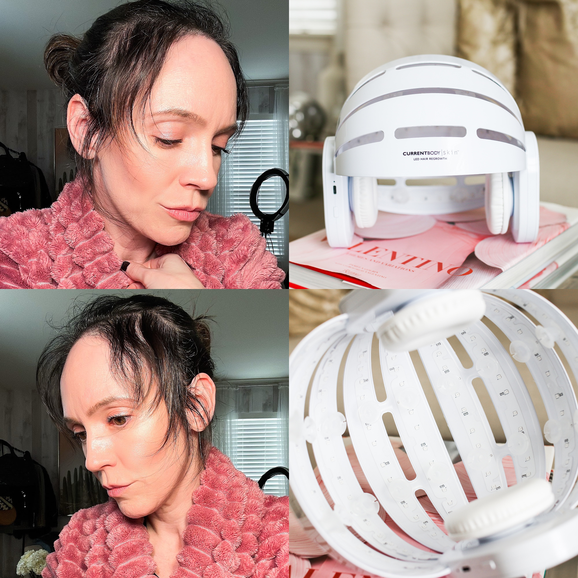 Currentbody LED Hair Growth Helmet review
